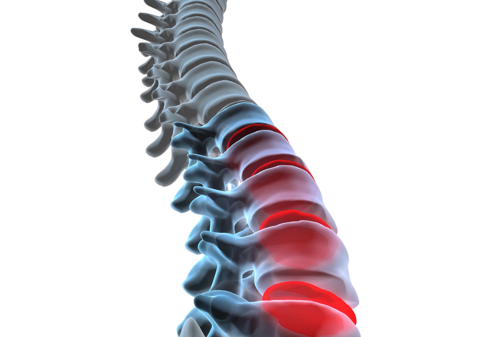 Leben mit Skoliose Osteopathie und Pilates: Ergänzungen zur klassischen Physiotherapie