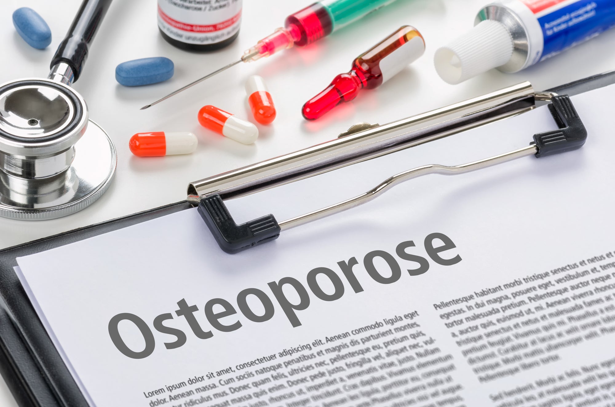 Osteoporose – knochenschwund als Schicksal?