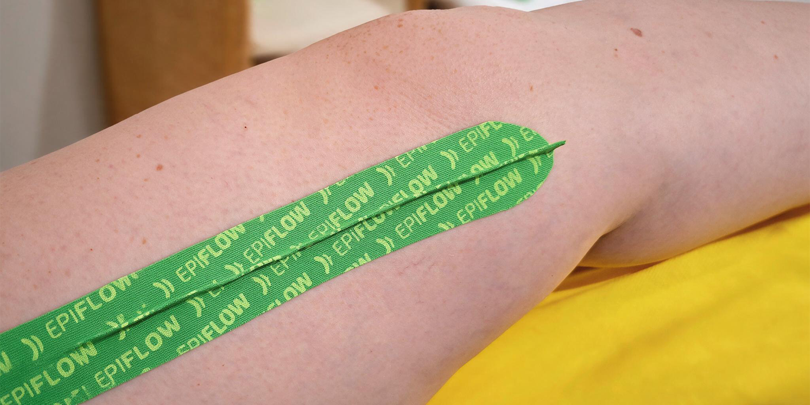 Epiflow Tape in Practice: Experiences from Lymphatic Drainage and Fascial Therapy