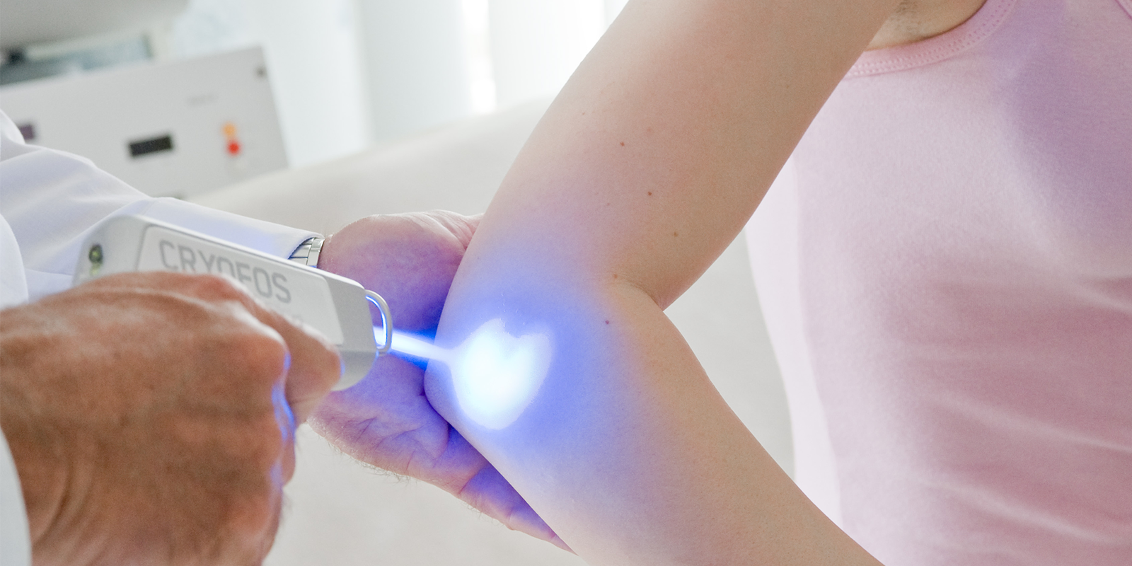 Neuroreflective pain therapy with Cryofos