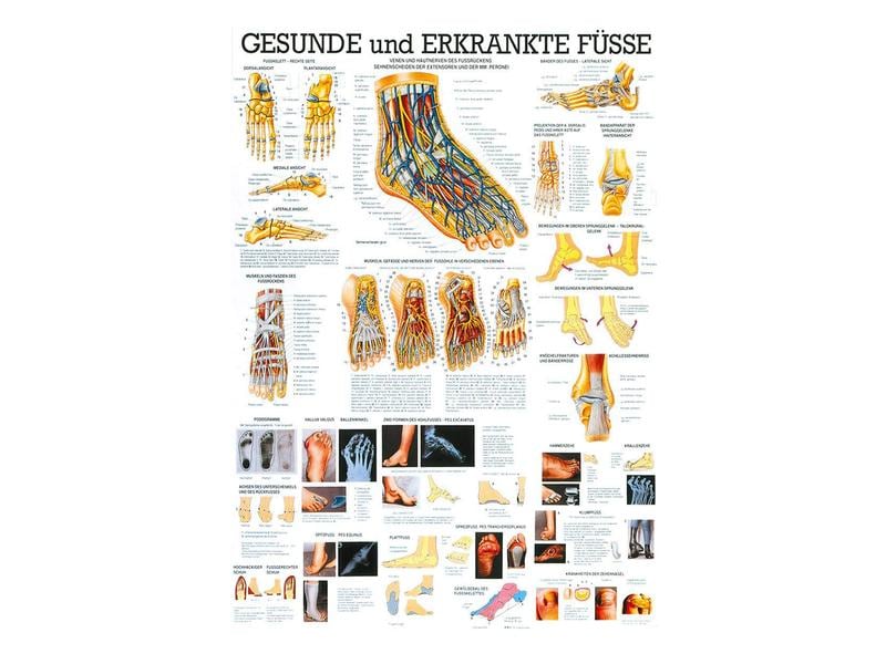 Rüdiger Planche anatomique Pieds sains &amp; malades laminé allemand