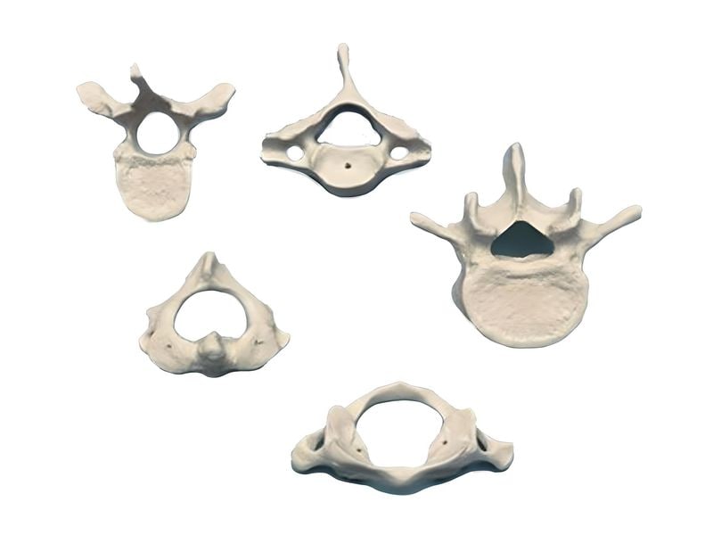 Rüdiger skeleton 5-vertebra set