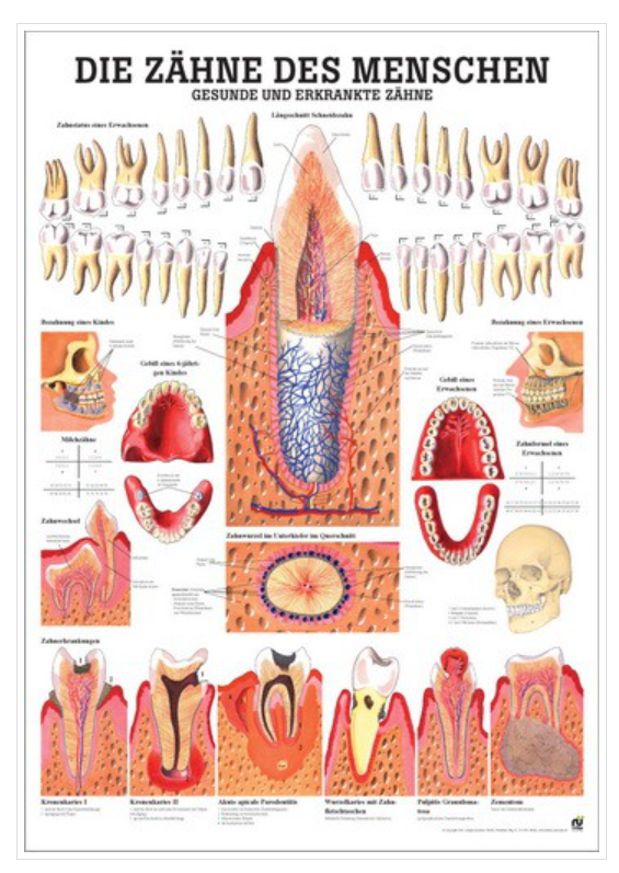 Rüdiger Anatomical teaching chart Healthy &amp; diseased teeth laminated German