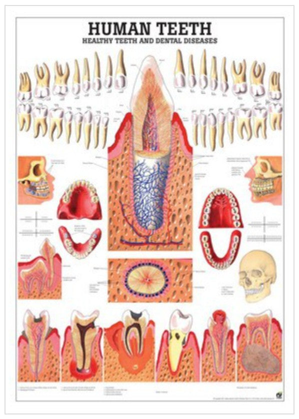 Rüdiger Anatomical Teaching Chart Healthy &amp; Diseased Teeth laminated English